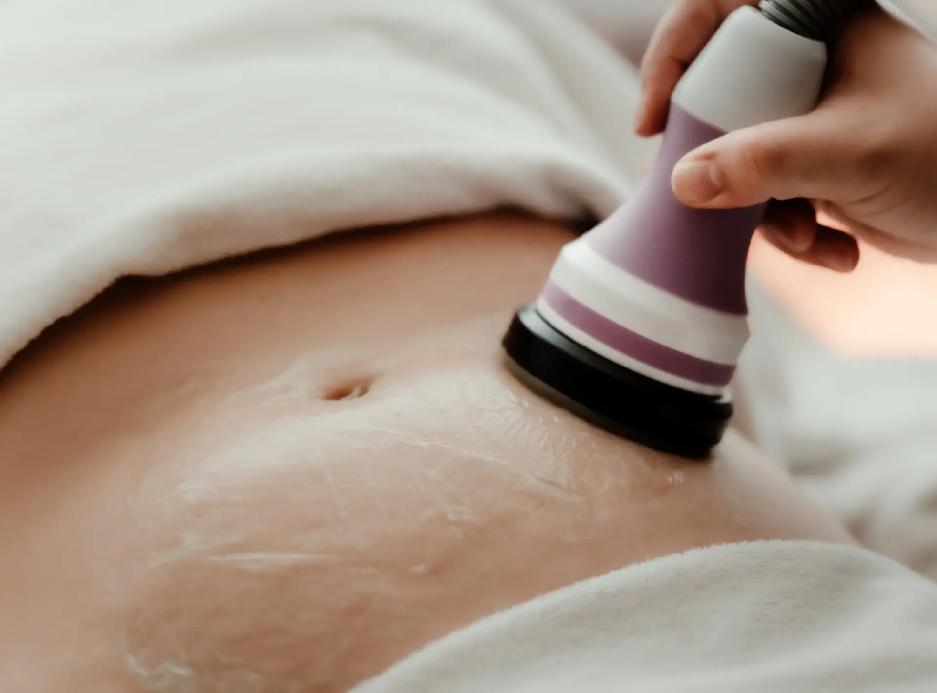 RF Body Contouring